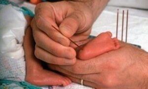 La prueba del talón en los bebés ahora también incluye la fibrosis quística