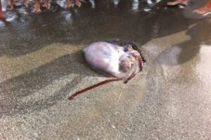 El tratamiento más efectivo y real contra las picaduras de las medusas