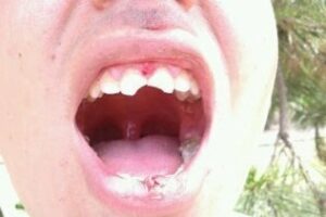 Yo reportero: "Para romperse los dientes". Sigue sin solución