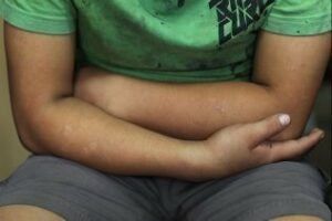 El realojo de 30 menores inmigrantes en un camping de Tarifa genera críticas de Podemos