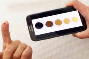 Análisis de sangre con el móvil