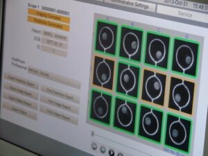 FIV Marbella, a la vanguardia en Fecundación in Vitro con una nueva prueba que mejora el éxito de los embriones