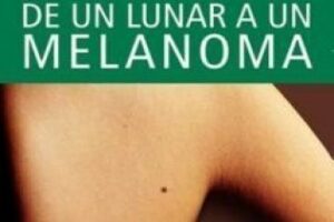 23 de mayo: Día Mundial del Melanoma