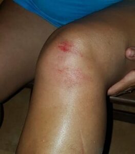 Yo reportero: Quejas por el estado de Getares