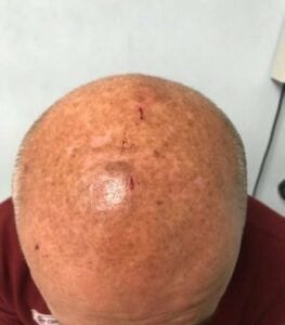 CCOO se suma a la denuncia por la agresión a un vigilante del centro de salud en el Saladillo