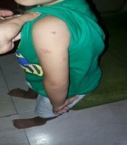 Denuncian una plaga de parásitos que asola al alumnado del CEIP Puerta del Mar de Algeciras