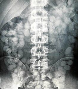 Denuncian constantes incautaciones de droga en el organismo de presos de Botafuegos